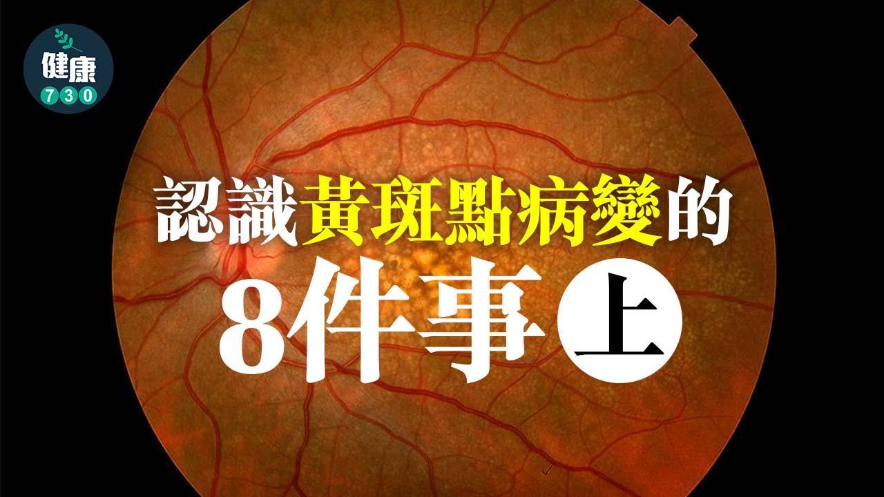 黃斑病變｜原因種類等8件事 分乾性及濕性(上)