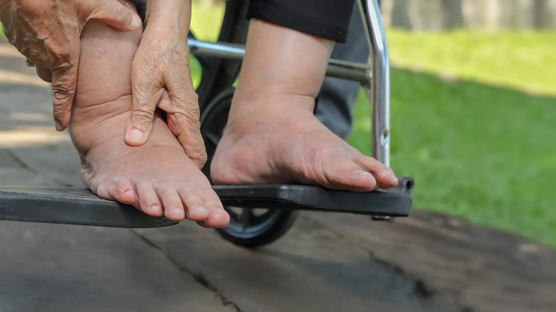 糖尿病患者的足部循環比較差，且汗液中含有葡萄糖，若未做好清潔，足部的傷口會如同培養皿一般，容易孳生細菌造成感染。