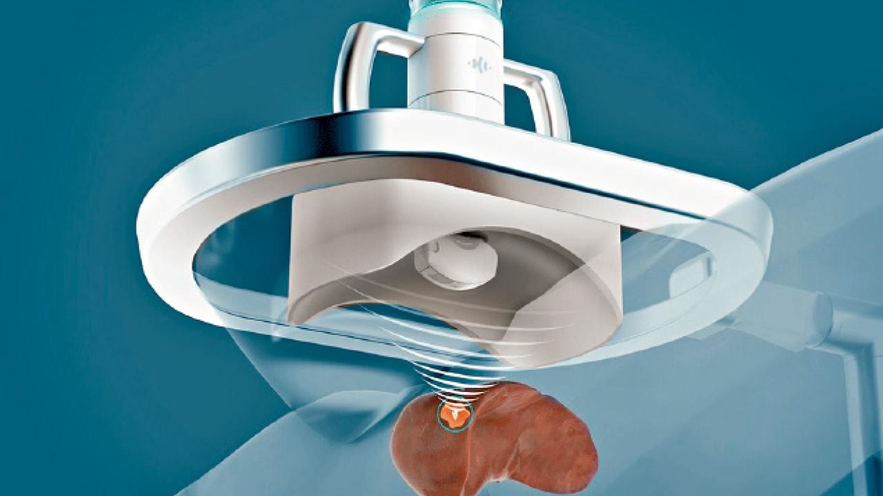 治癌神器中期療效良好