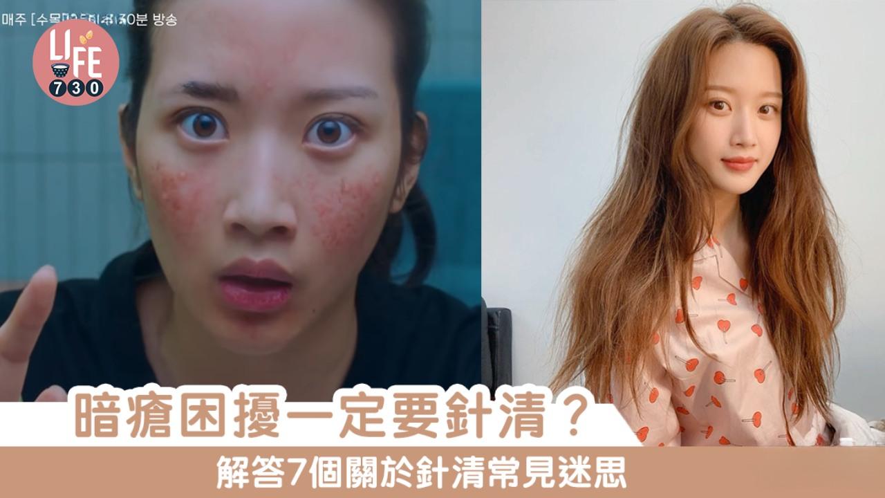 暗瘡針清迷思 不當處理或爆瘡或留疤痕（am730製圖）