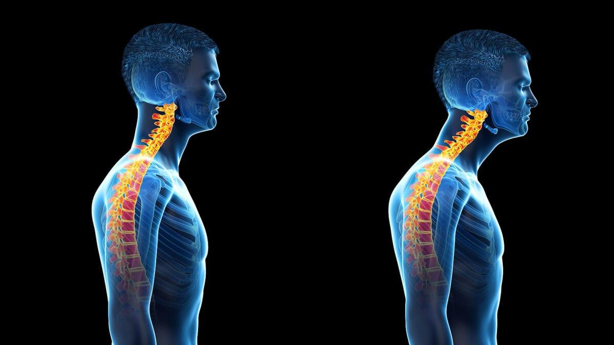 兩個運動 改善上背體態