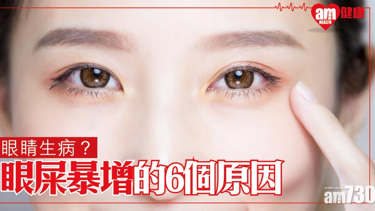 眼屎多是甚麼原因？乾眼症/吃得油膩/發炎等6大形成可能（am730製圖）