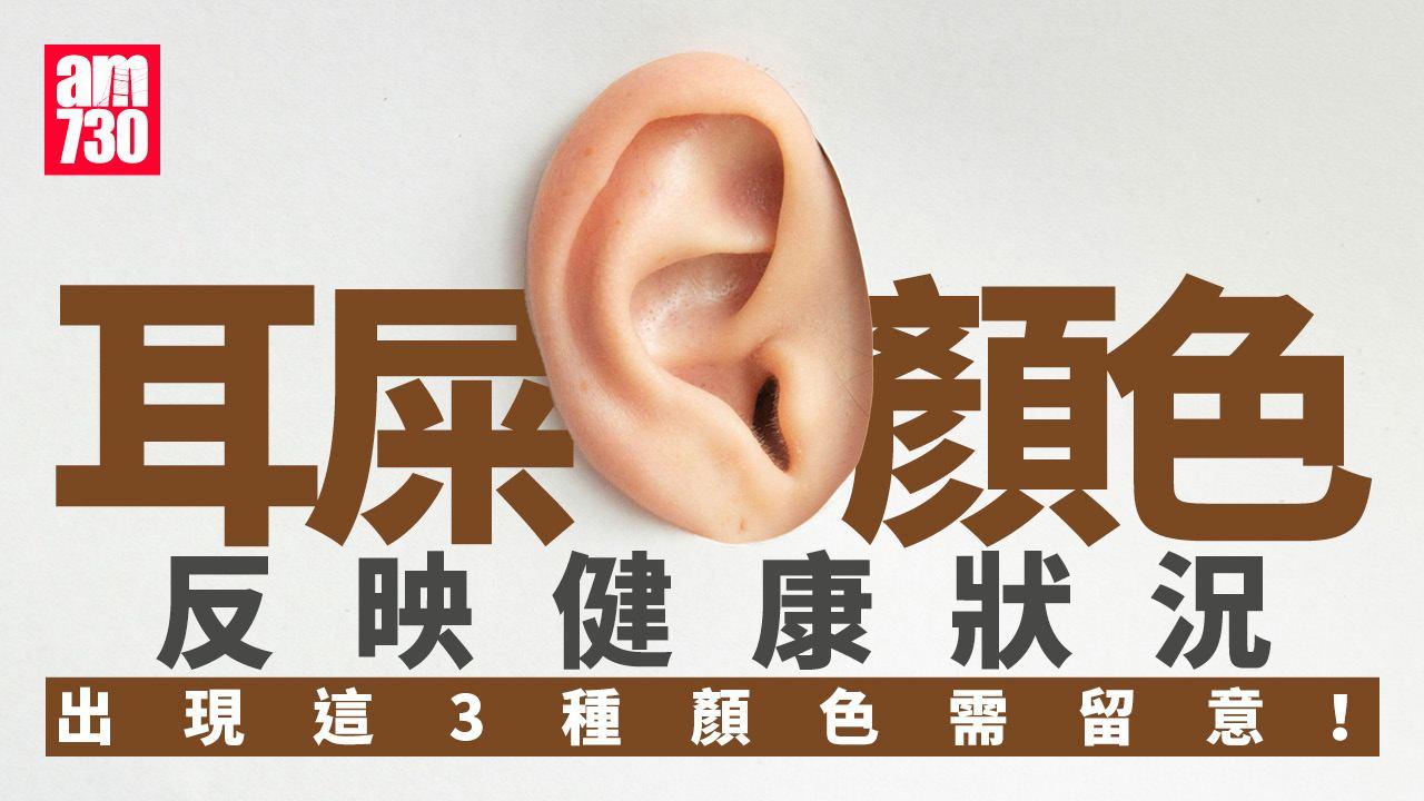 耳屎顏色反映健康狀況　出現這3種顏色需留意！