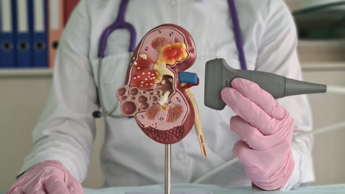 器官移植能減少透析依賴、擺脫尿毒症威脅，有效改善心血管和免疫系統功能，延長壽命。