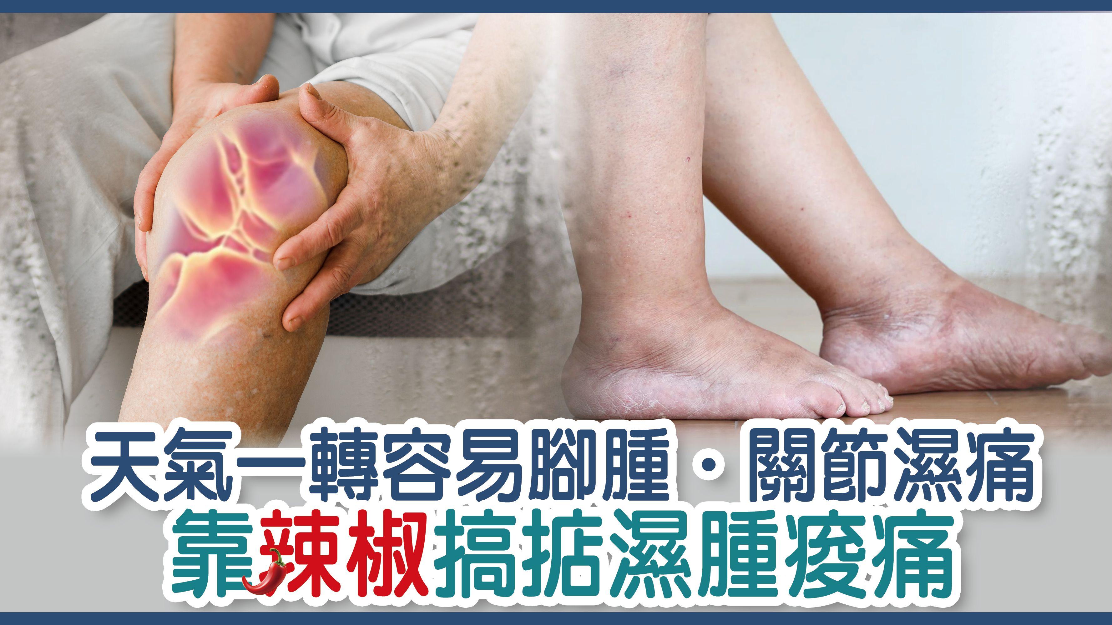天氣一轉容易腳腫 ‧ 關節濕痛　靠辣椒搞掂濕腫痠痛？