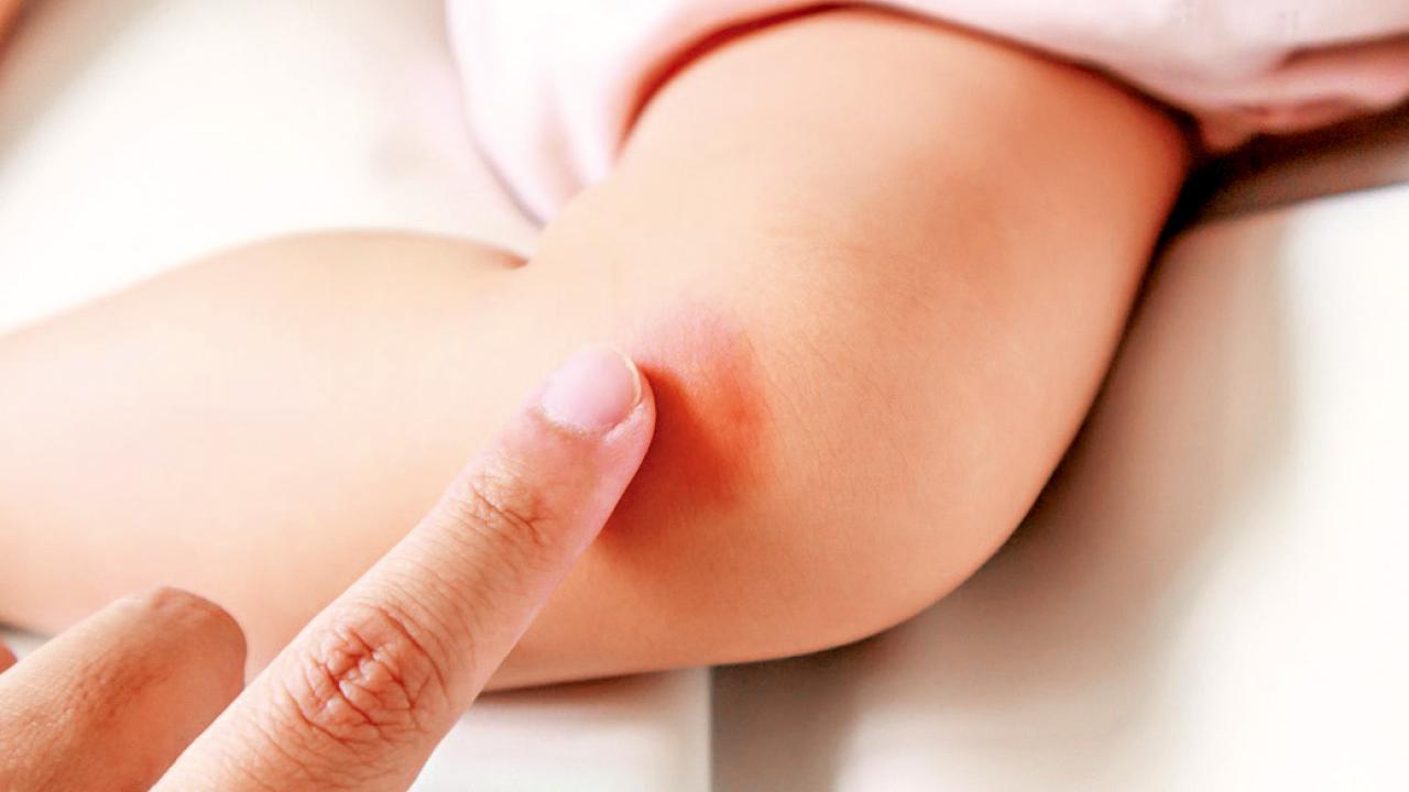 藥物治療皮膚敏感最終目的