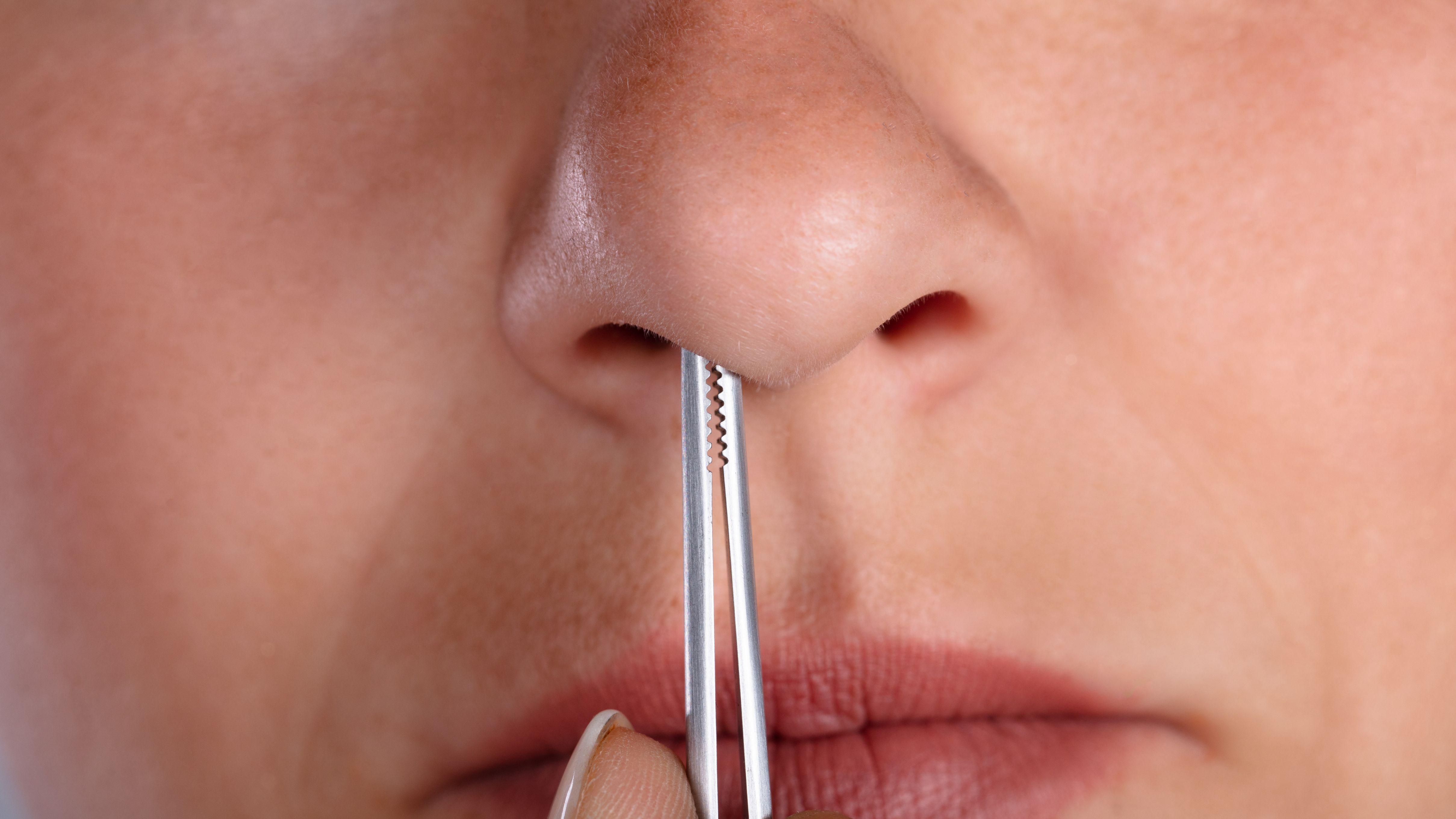 鼻毛 鼻毛外露 感染危機 危險三角區 細菌感染 修剪鼻毛