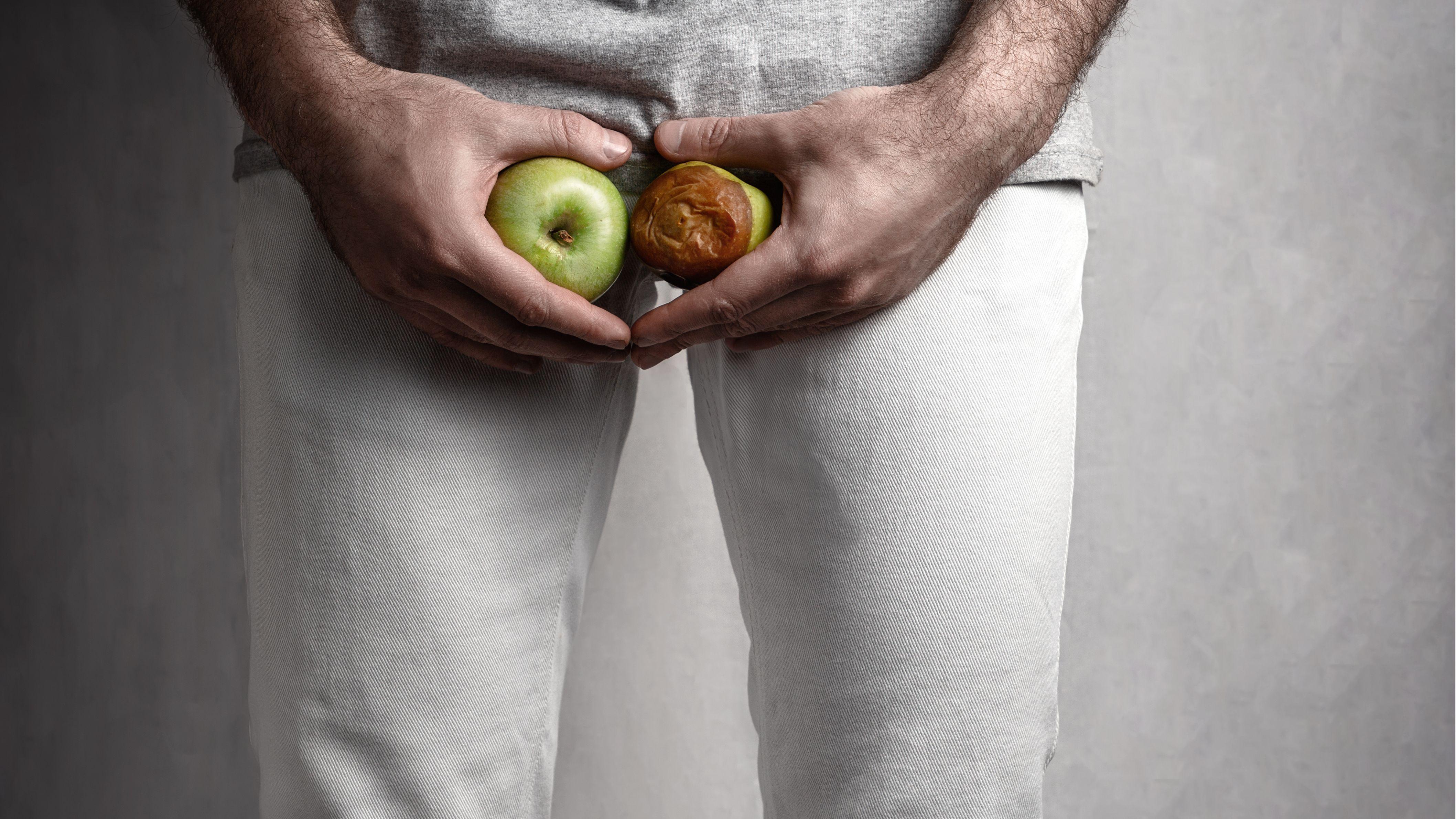 陰囊 精索靜脈曲張 靜脈曲張 不孕 睪丸 男性疾病