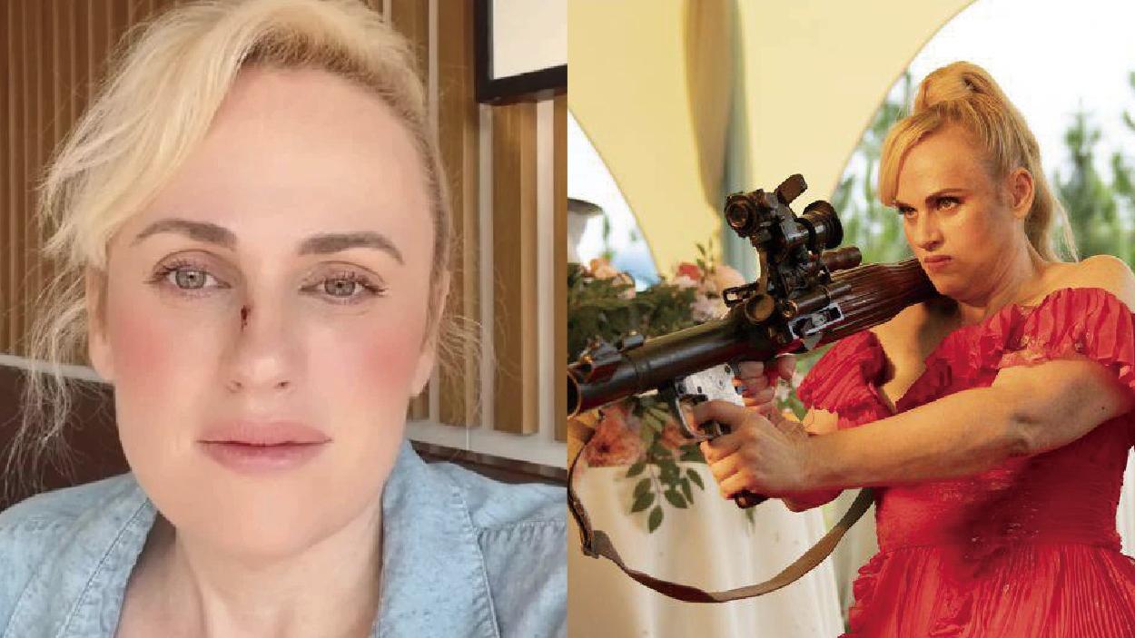 Rebel Wilson拍《Bride Hard》受傷險毀容  自勉：現在可叫動作明星