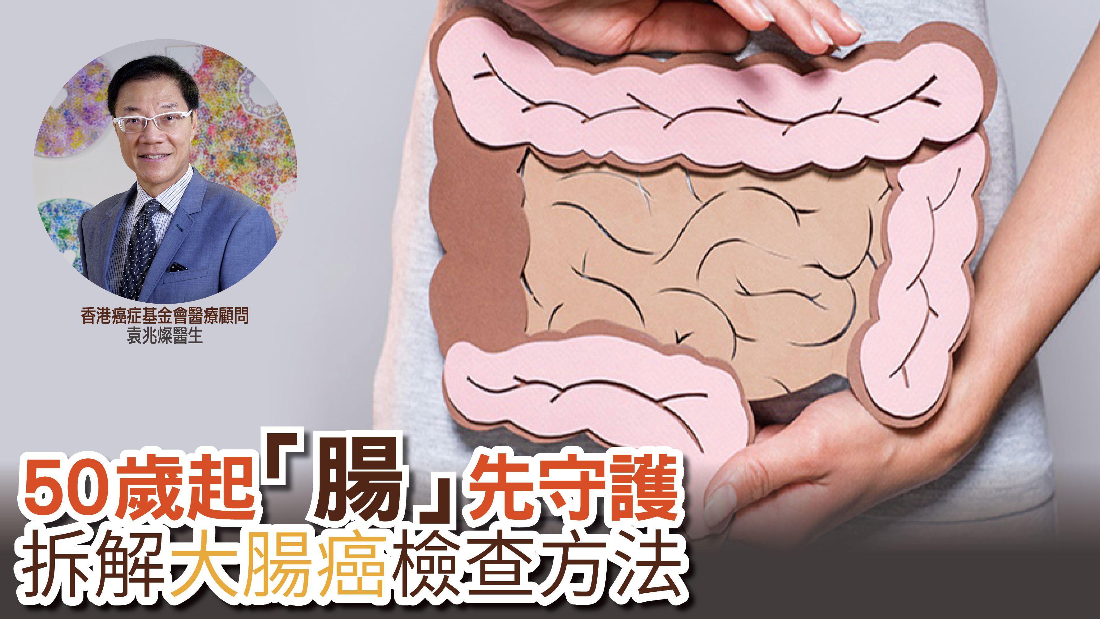 50歲起「腸」先守護 拆解大腸癌檢查方法