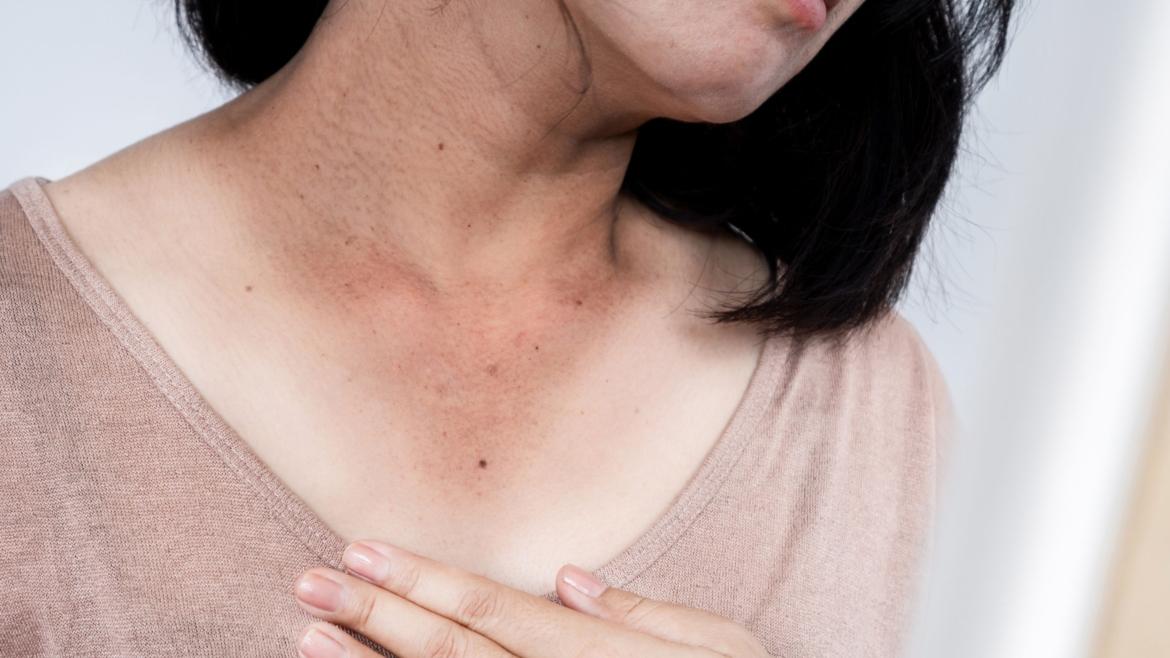 黑色素細胞(Melanocyte)分布在皮膚底層，而「黑色素」正是由黑色素細胞內的黑色素小體(Melanosome) 負責合成，用以保護肌膚免受紫外線的傷害。