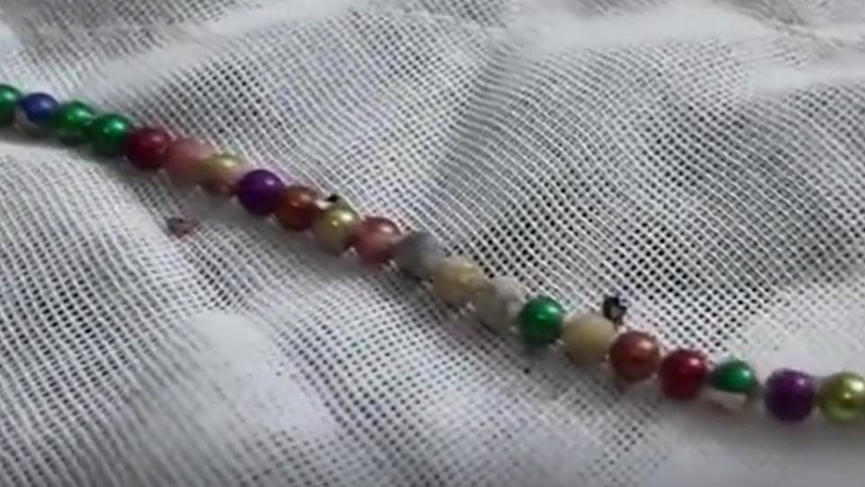 內地13歲少年性好奇　塞72顆磁力珠入膀胱致血尿