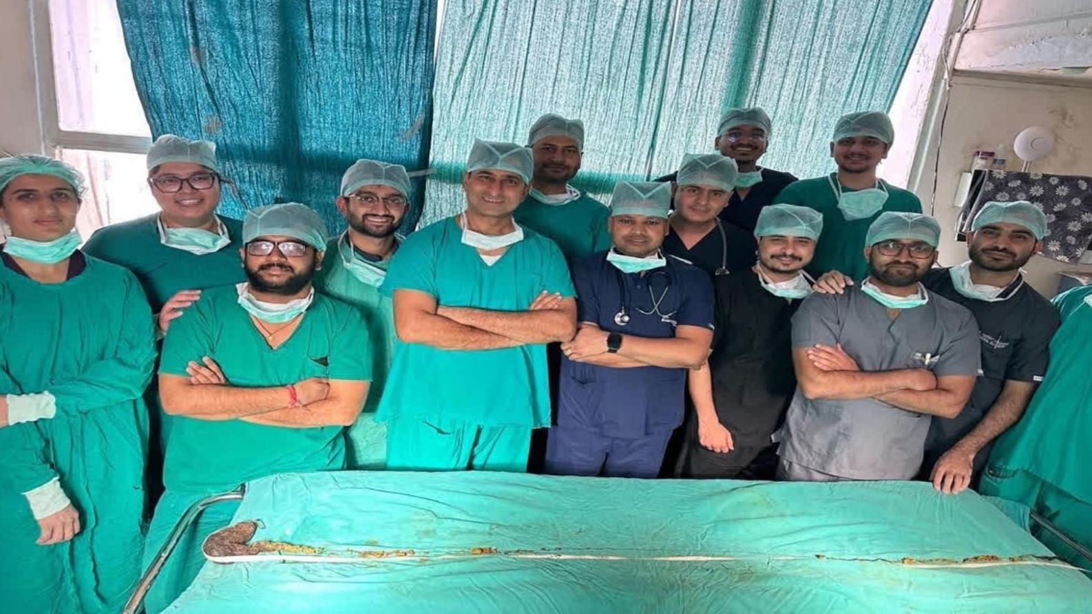 醫生團隊展示從少女胃部取出的210厘米長毛球。(互聯網)