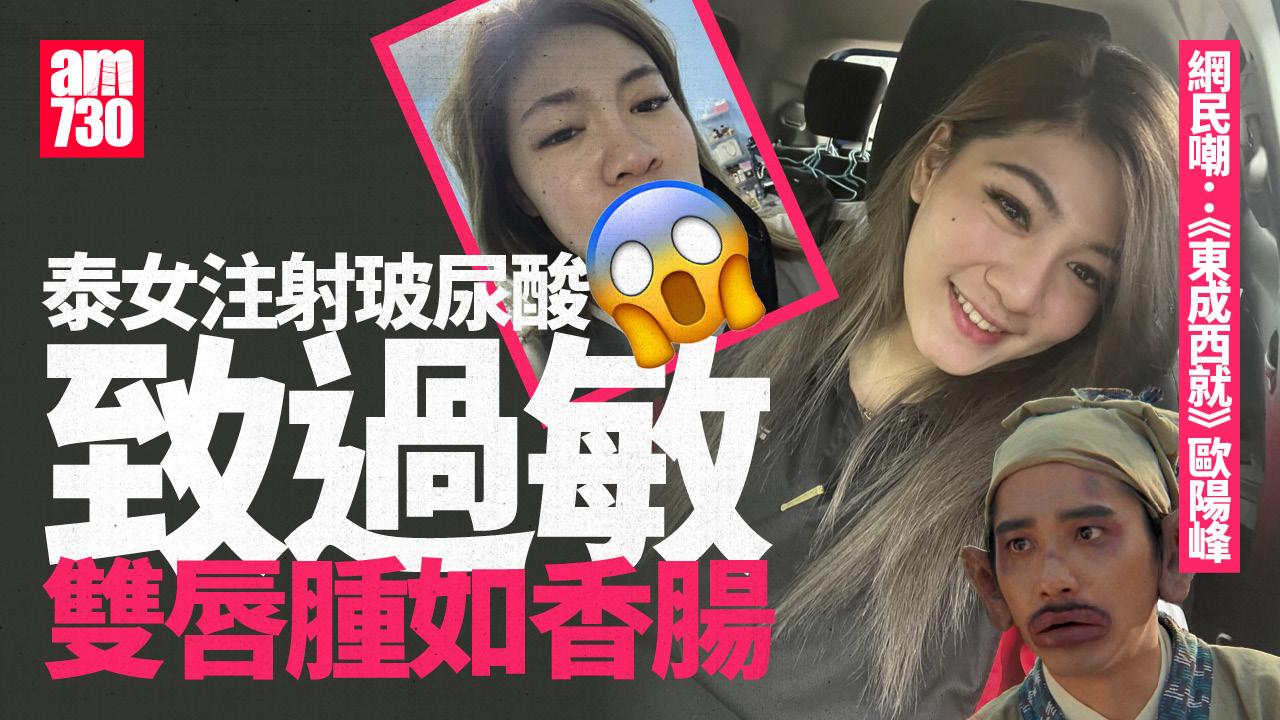 美女注射玻尿酸過敏唇腫如香腸　網民嘲：《東成西就》