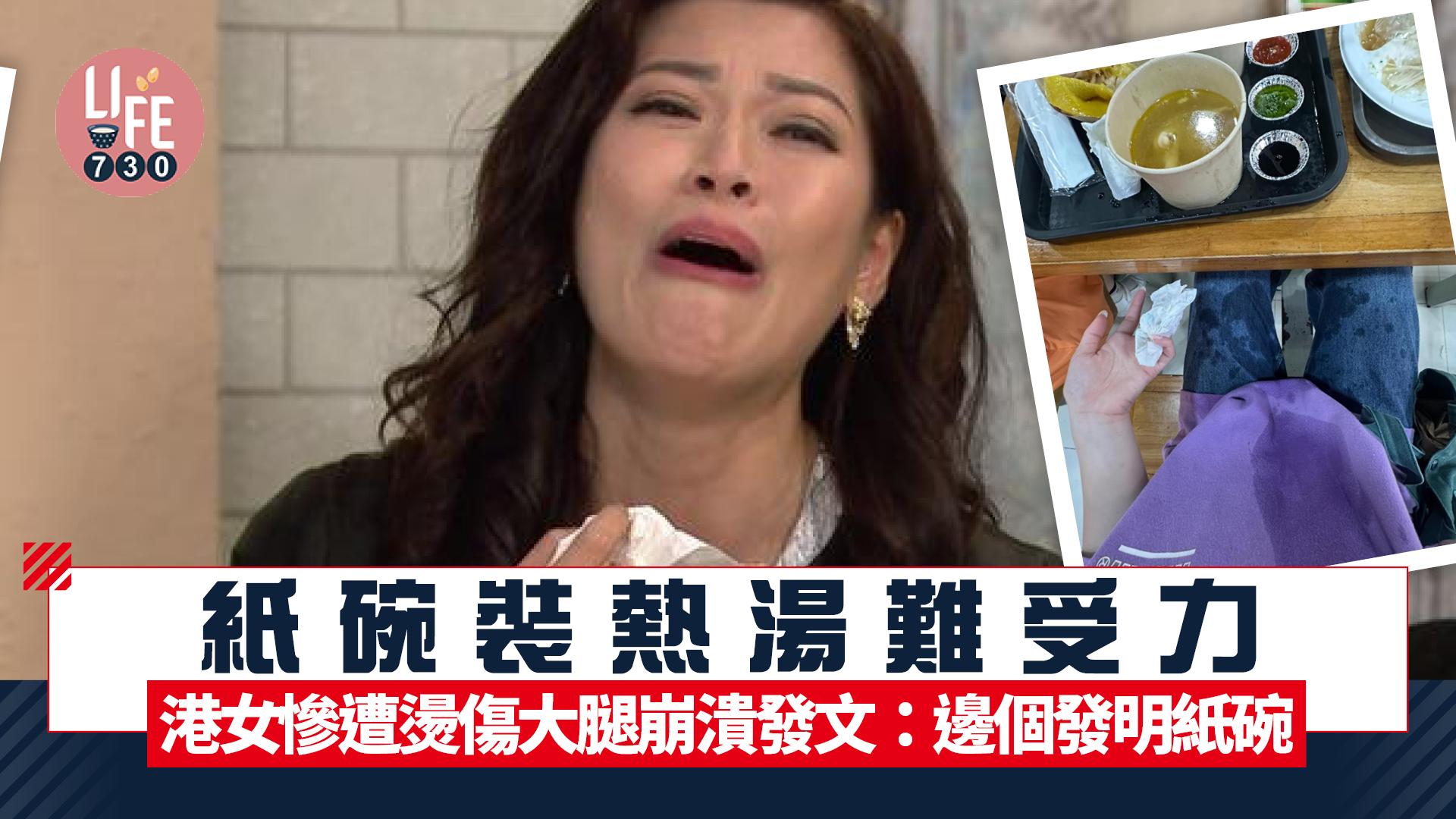 網上熱話｜紙碗裝熱湯難受力 港女慘遭燙傷大腿崩潰發文：邊個發明紙碗