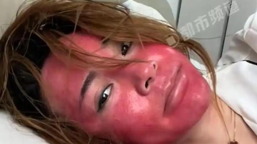 高女士自稱22年不卸妝導致臉紅如「關公」。 （圖／翻攝河南都市頻道）