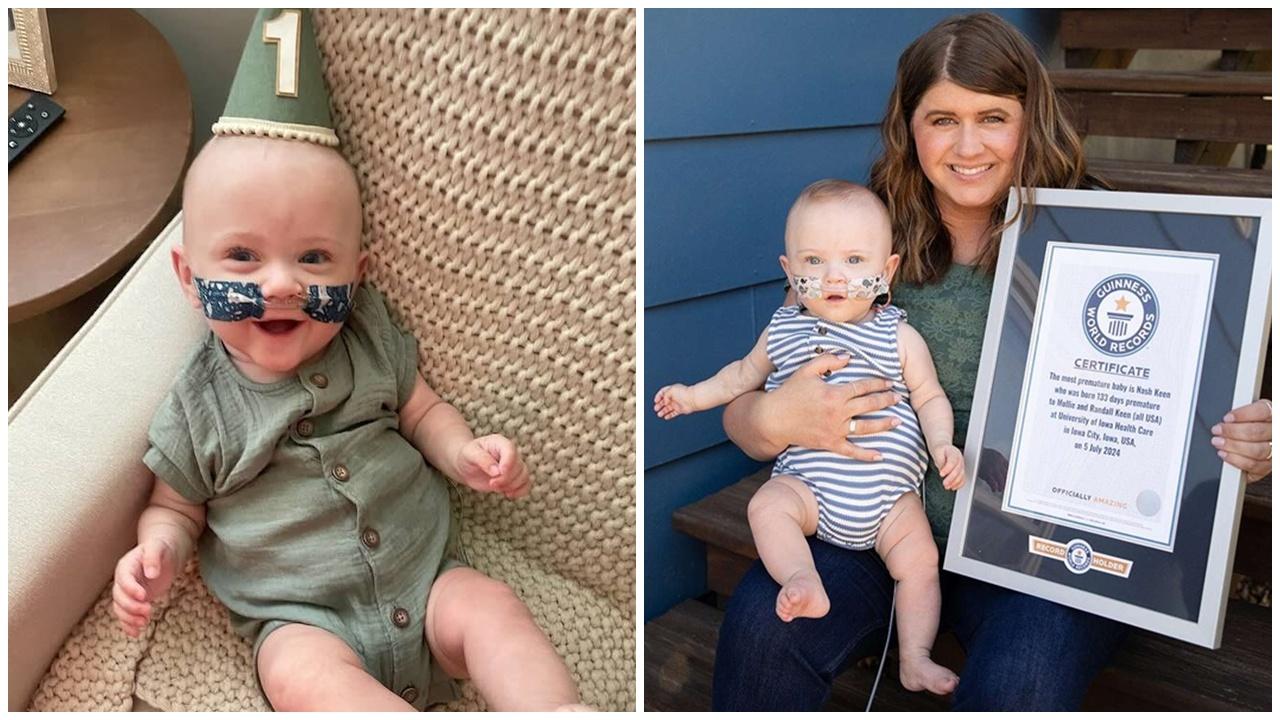 21周早產嬰滿1歲，正式獲認證為最提早出世嬰兒。(X)