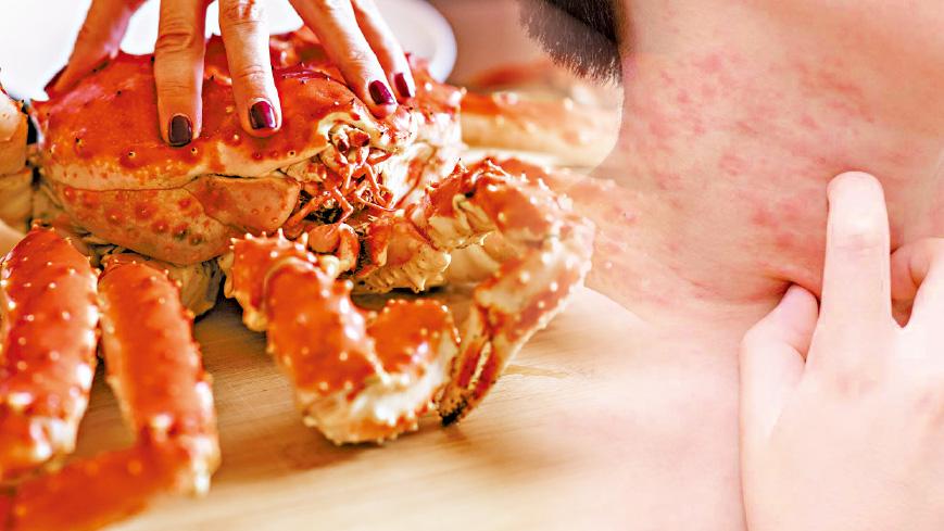 蟹致敏原多達11種 診治須精準