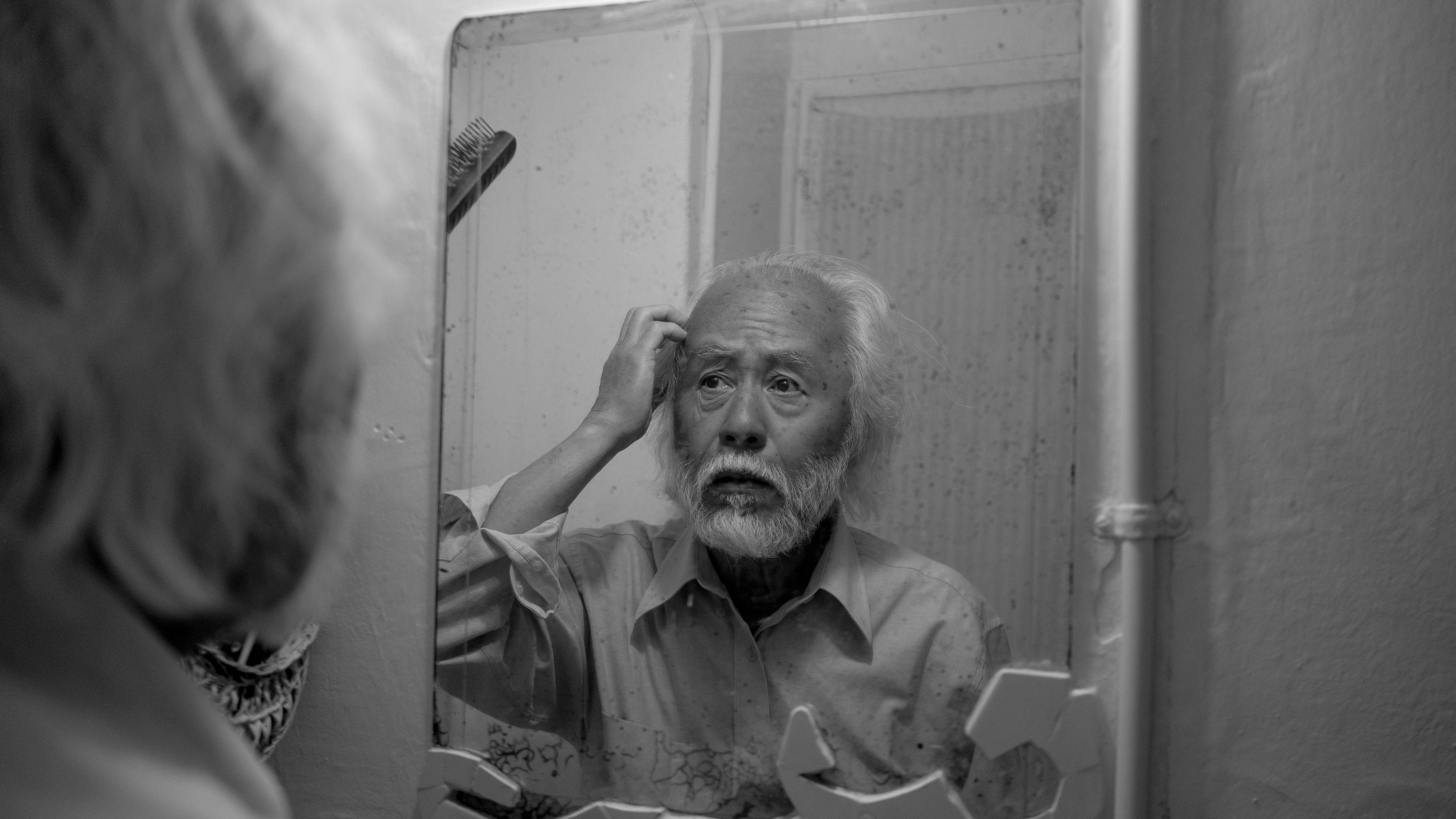 阿茲海默症 記憶力衰退 失智 神經退化性疾病 喪失記憶 語言障礙 眼晴疾病