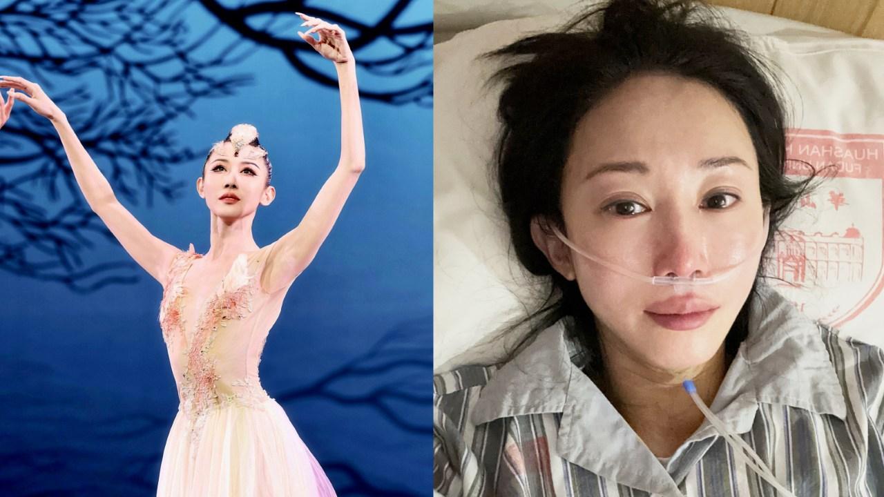 著名舞蹈家朱潔靜曾患乳腺癌 接受25次放化療 瞞著家人赴春晚彩排
