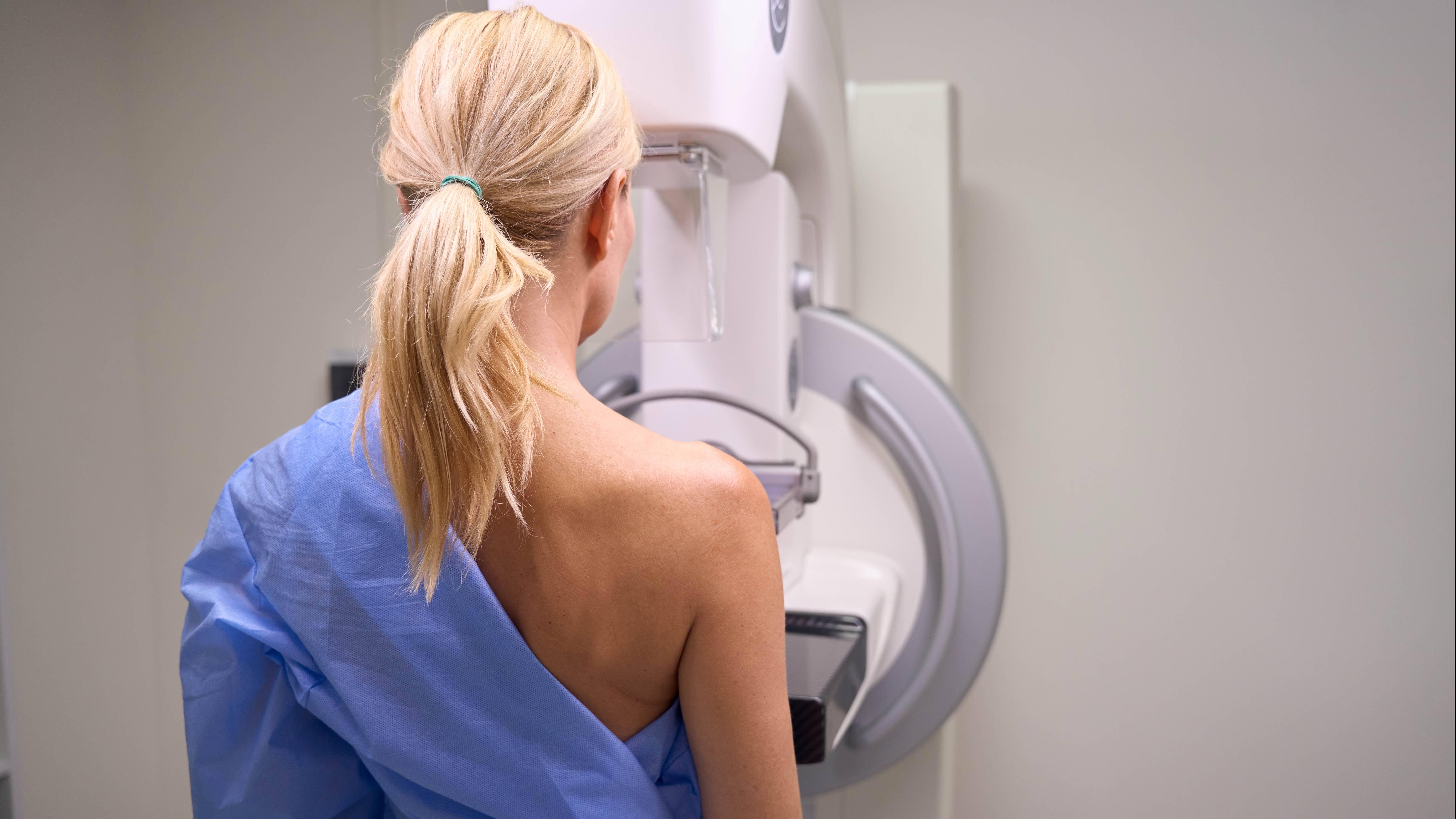 乳癌警號：全球第二常見癌症 港女每14人有1人受影響