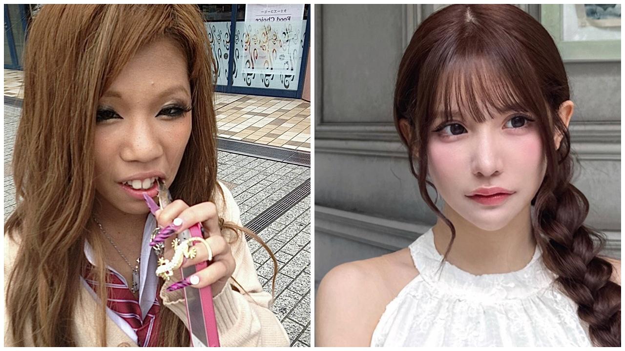 擲137萬整容稱徹底改變人生，28歲網紅：投資名牌袋不如投資在臉上。(X)