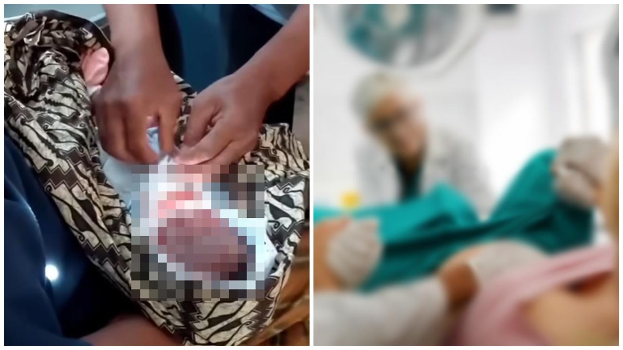 婦人分娩4.2公斤嬰兒，頭被扯斷震驚民眾。