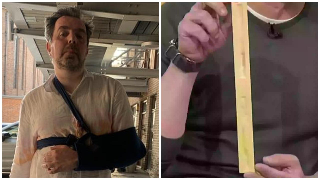 37厘米「巨雕」男之苦，洗澡被遮擋視線滑倒骨折。(X)