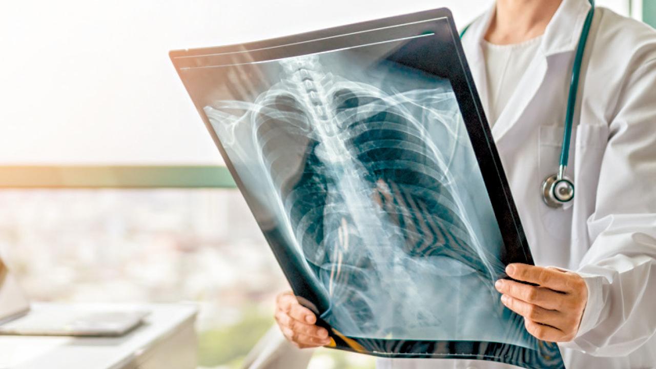 我為甚麼不同意港大的肺炎研究