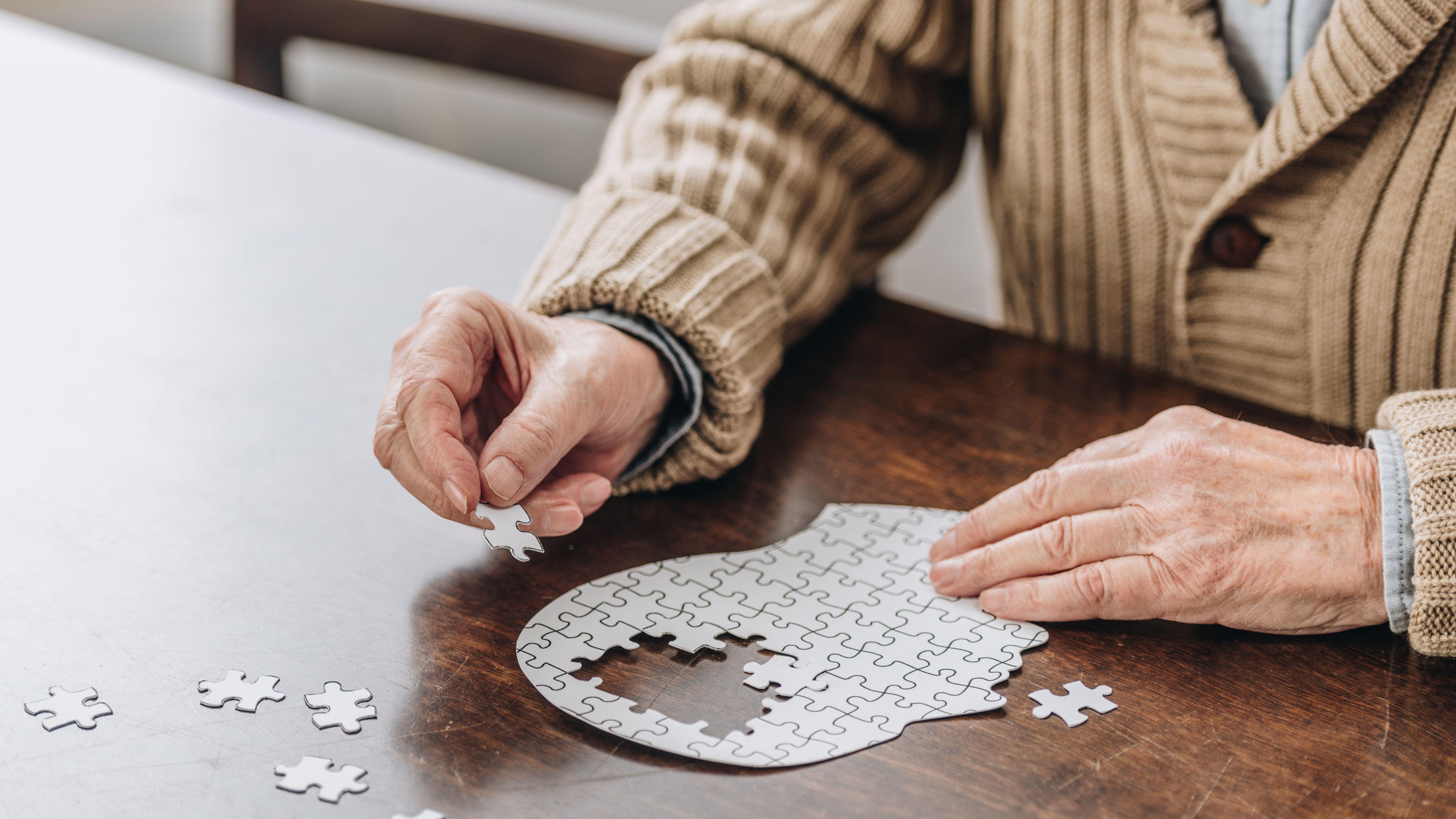 腦霧 健忘 健腦 腦退化 營養師  營養 保護大腦 記憶力差