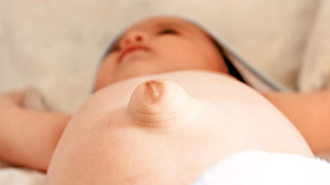 腹股溝摸到腫塊 小心兒童疝氣