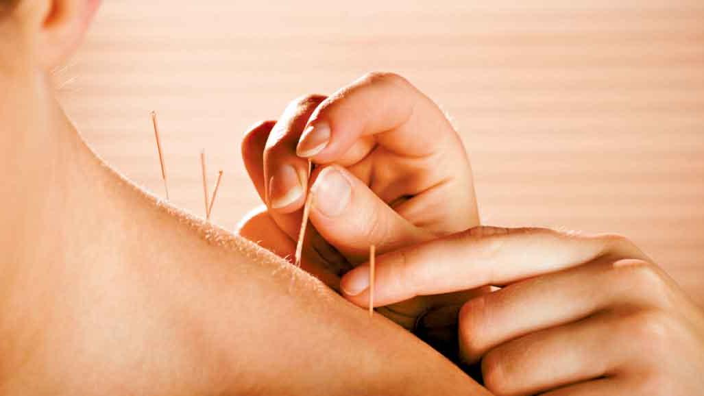 中醫治療蛇串瘡後遺疼痛