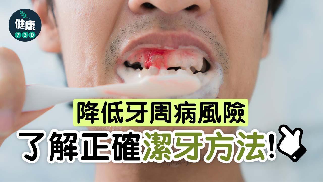 刷牙正確方法｜降低牙周病風險 舌側最常刷不乾淨！