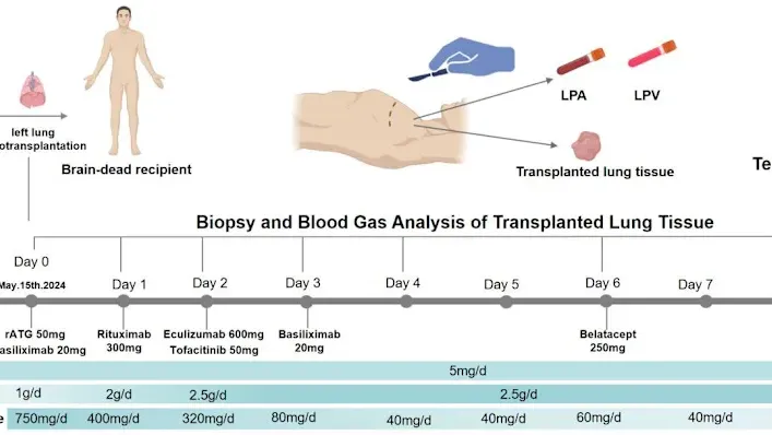 內地團隊完成全球首例基因編輯豬肺移植人體　成功存活9天