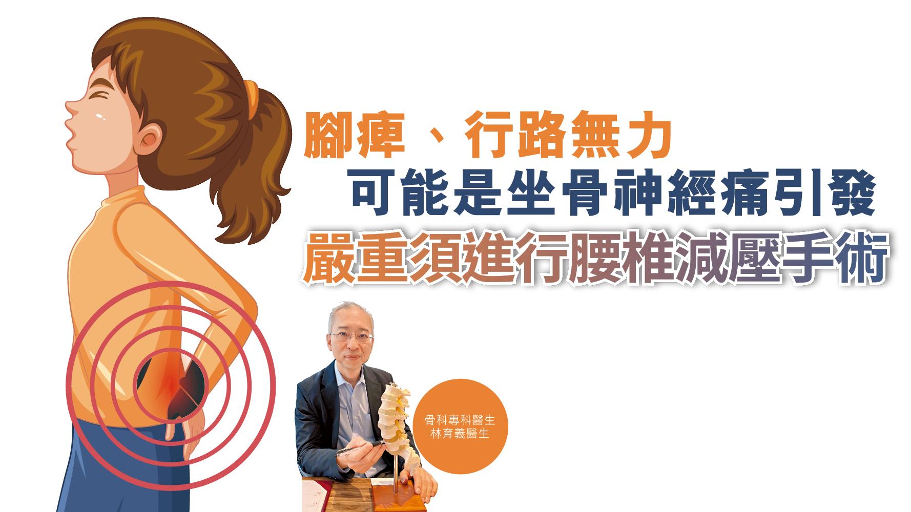 健康解碼｜腳痺、行路無力可能是坐骨神經痛引發 嚴重須進行腰椎減壓手術