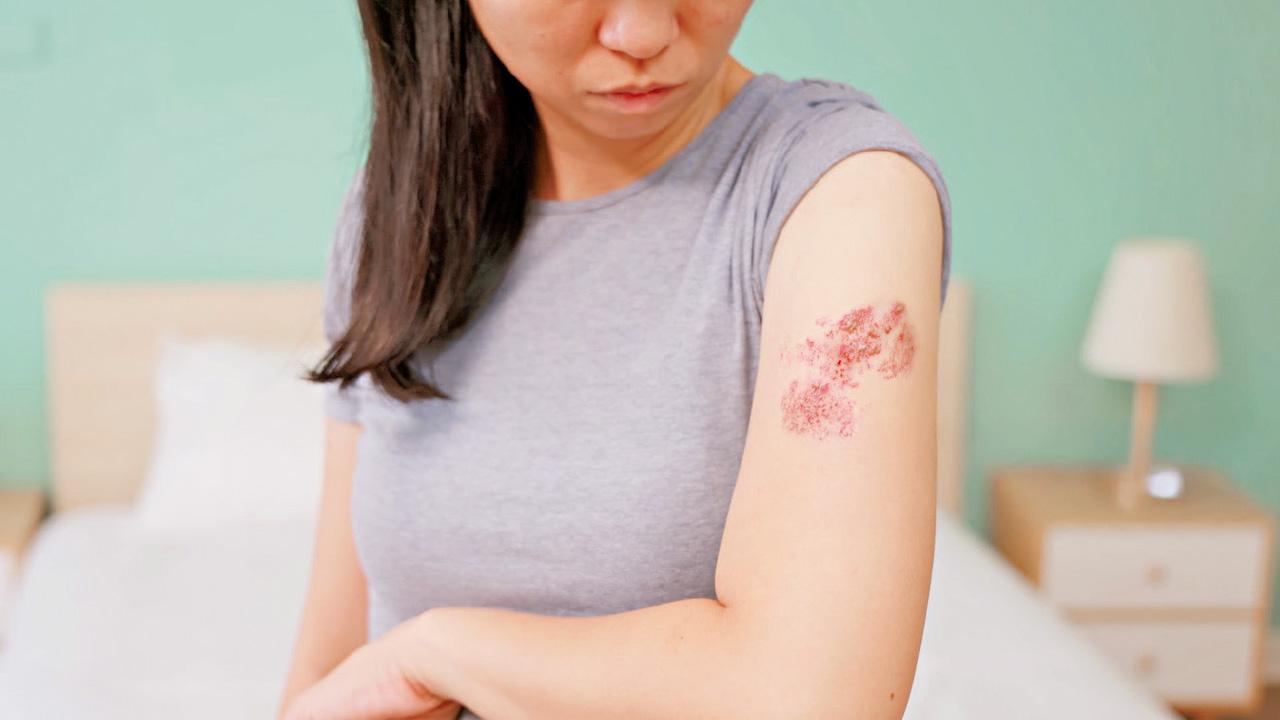 腎有事易生蛇 現併發症高達15倍