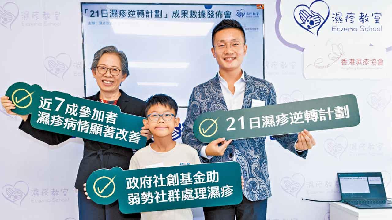 加強保濕 改善營養 21日逆轉濕疹