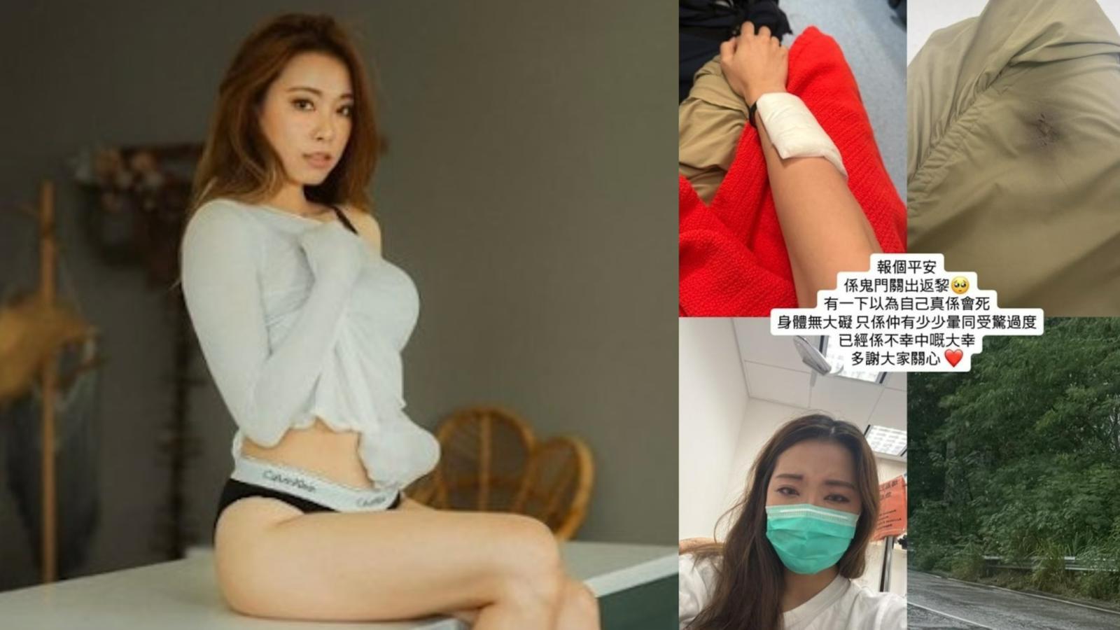 東張女神發生車禍險死 俞可程自爆受驚過度