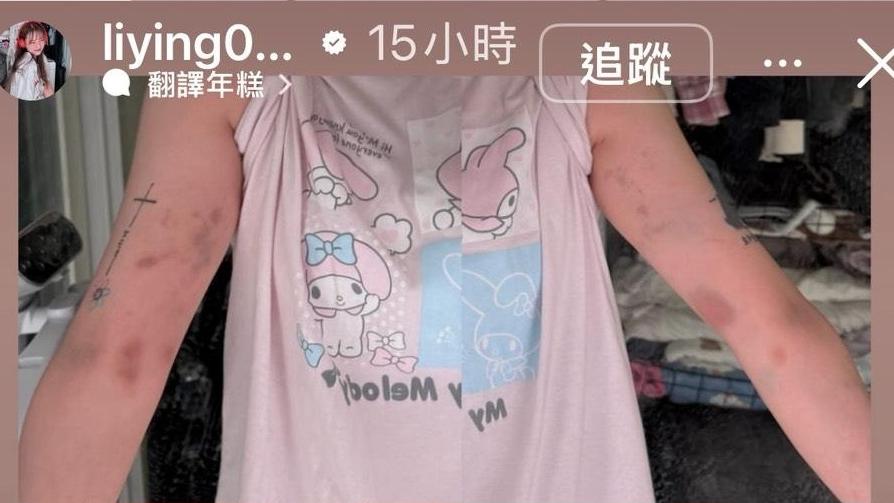 台灣女網紅南韓遭陌生男搭訕拒「過夜」 遭暴打周身瘀傷手指骨折