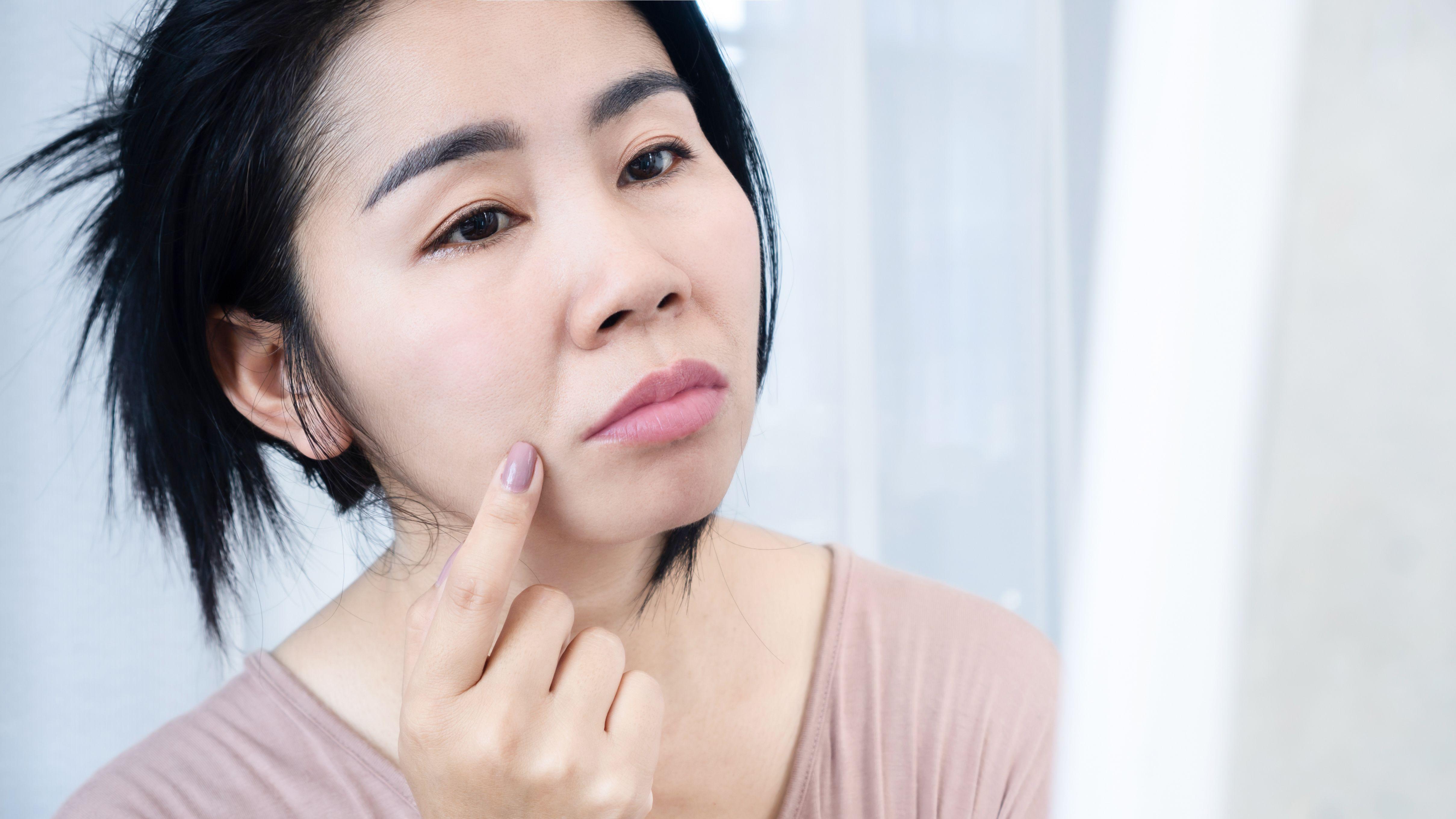 法令紋 皺紋 醫學美容 鼻唇溝 皮膚 壓力 壓力 衰老 老化