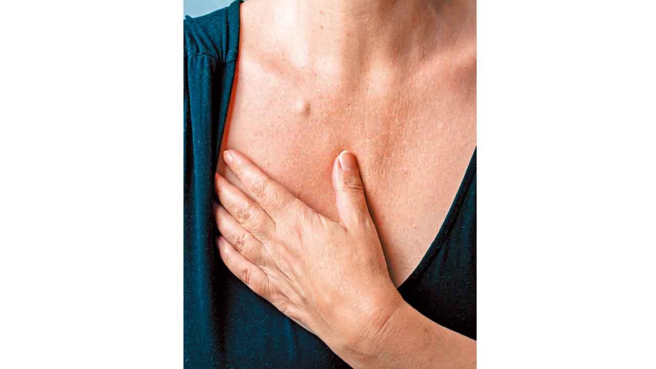 粉瘤勿用手擠 隨時發炎