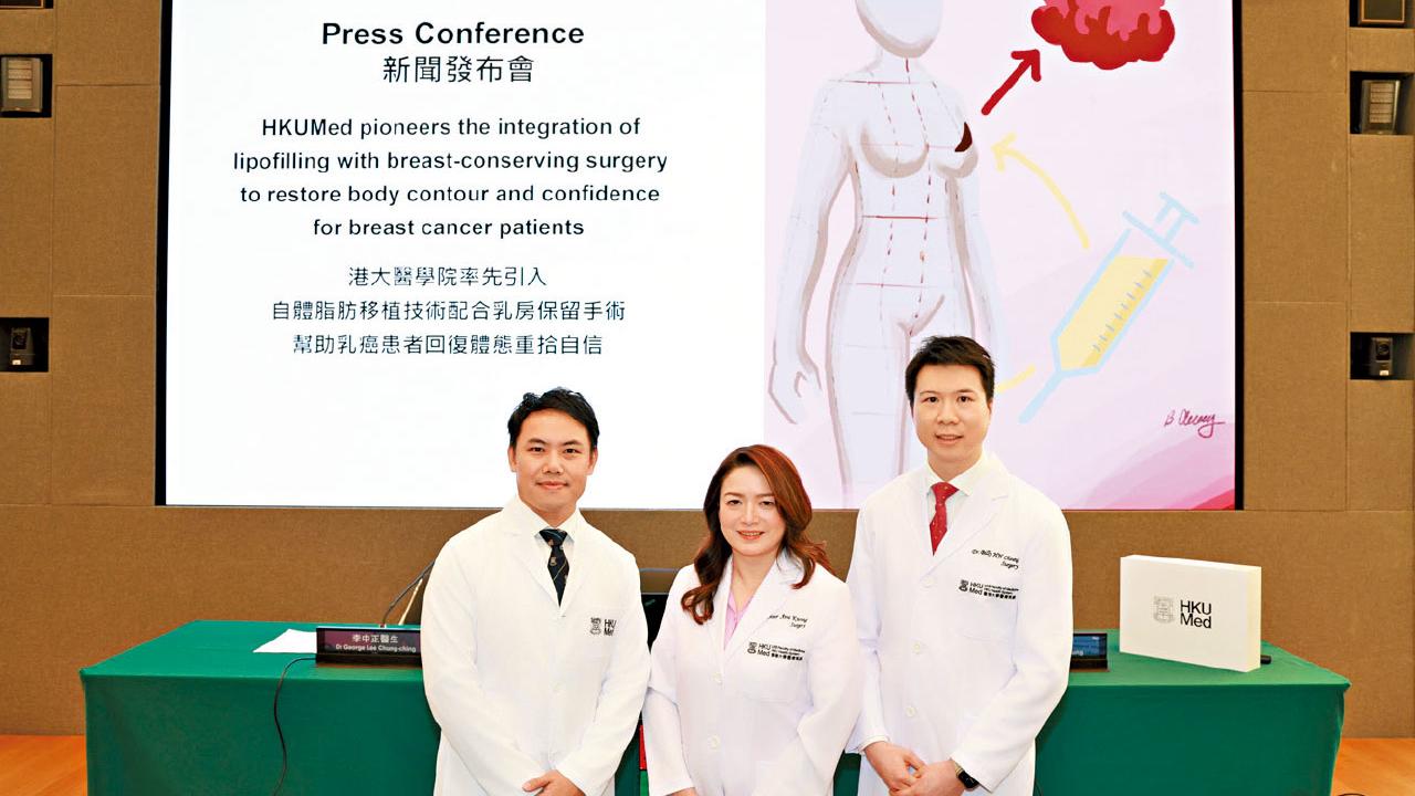 自體脂肪移植配合乳房保留手術 港大團隊︰患者創傷小 復原快