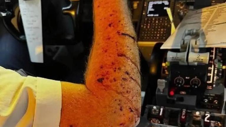 聯合航空機師血濺駕駛艙 擋風玻璃疑遭太空垃圾撞裂須急降