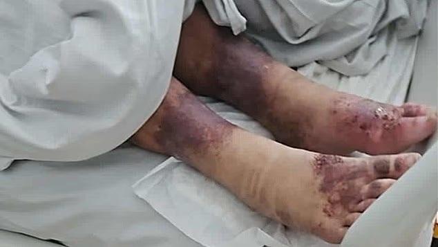 女子遭父母禁錮27年被發現時就快死 最後一次踏出家門15歲