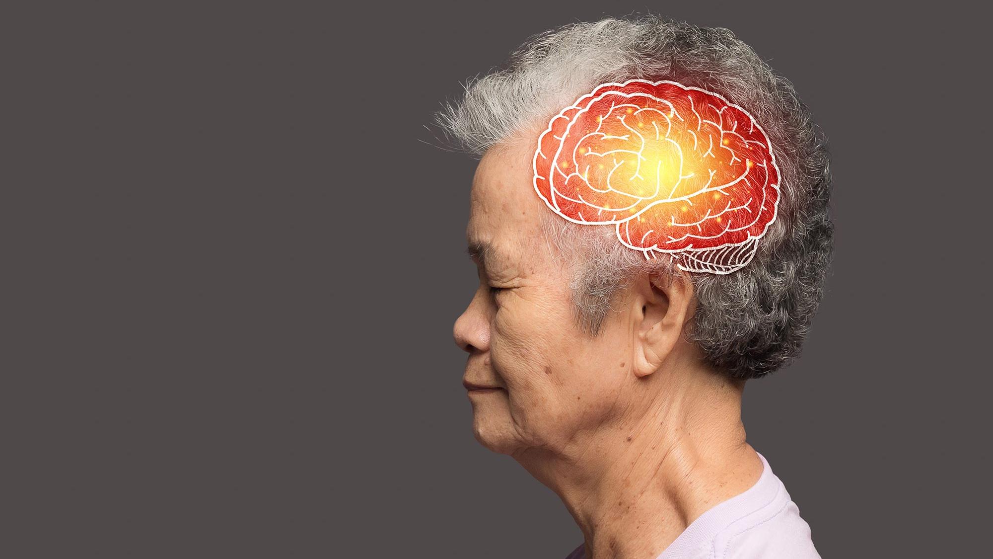 阿茲海默症傳統藥物主要作用在改善記憶、專注或行為等認知行為症狀，卻無法阻止病程退化。