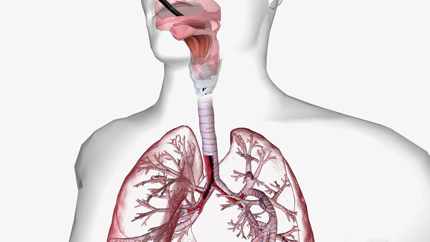 肺癌診斷新模式！一文睇清「AI支氣管鏡導航系統」技術應用、臨床趨勢
