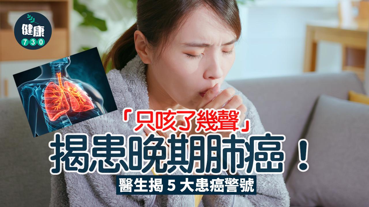 肺癌 患癌 癌症 咳嗽 肺腺癌 腫瘤