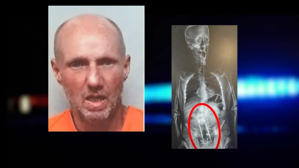 X光片驚見保溫瓶？美國51歲漢入獄藏私伙物品不果