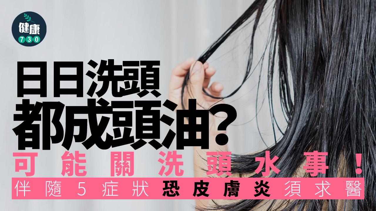 洗頭 頭油 洗頭水 皮膚炎 頭皮 皮脂腺 脫屑 脫髮