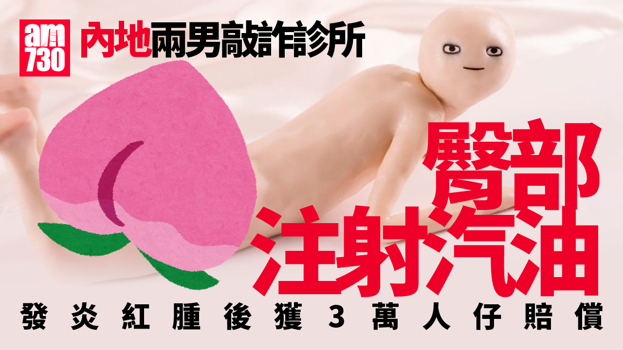 騙案｜兩男臀部「注射汽油」敲詐診所 發炎紅腫獲3萬回報